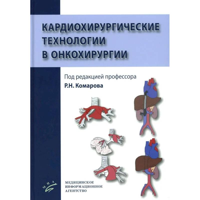 Кардиохирургические технологии в онкохирургии