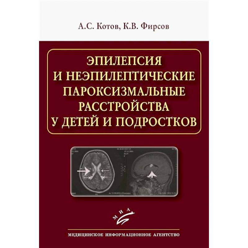 Эпилепсия и неэпилептические пароксизмальные расстройства у детей и подростков