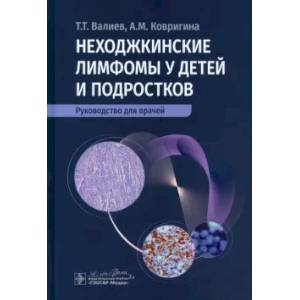 Неходжкинские лимфомы у детей и подростков: руководство для врачей