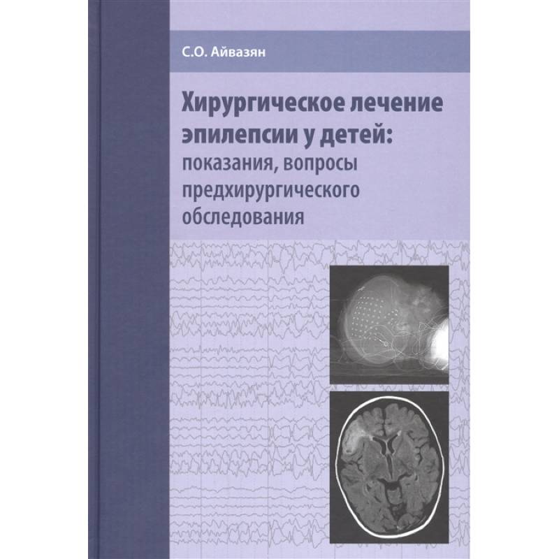 Хирург 1 том. Хирургическое лечение эпилепсии. Ужасная медицина книга.