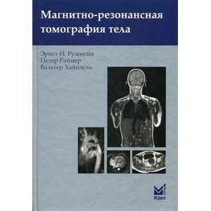 Магнитно-резонансная томография тела
