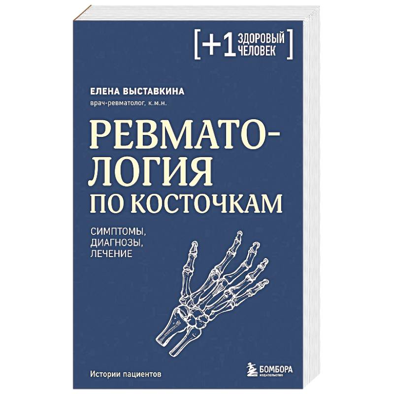 Ревматология по косточкам. Симптомы, диагнозы, лечение