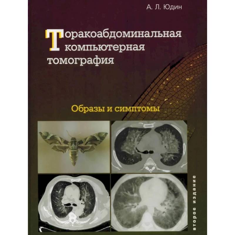 Торакоабдоминальная компьютерная томография. Образы и симптомы