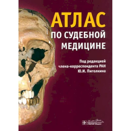 Криминал, книга Атлас по судебной медицине купить по скидке