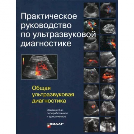 УЗИ. ЭКГ. Томография. Рентген, книга Практическое руководство по ультразвуковой диагностике. Общая ультразвуковая диагностика купить по скидке