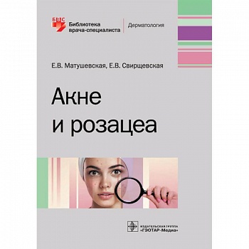 Акне и розацеа