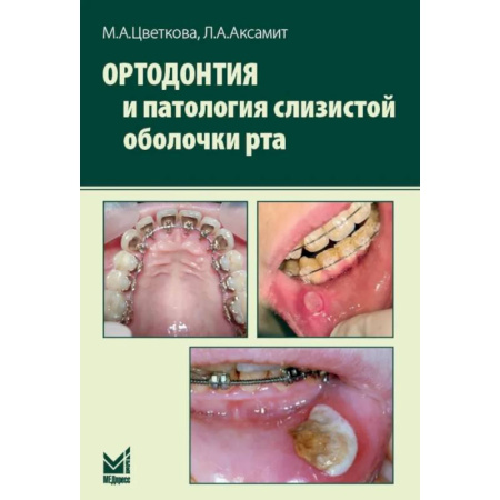 Стоматология, книга Ортодонтия и патология слизистой оболочки рта купить по скидке