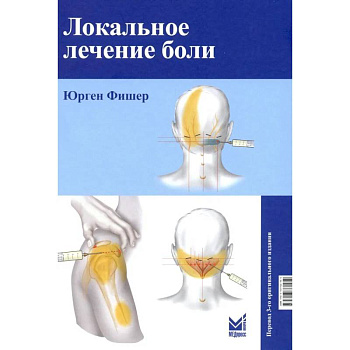 Локальное лечение боли