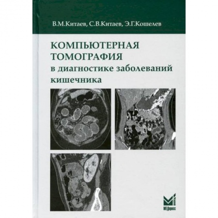 УЗИ. ЭКГ. Томография. Рентген, книга Компьютерная томография в диагностике заболеваний кишечника купить по скидке