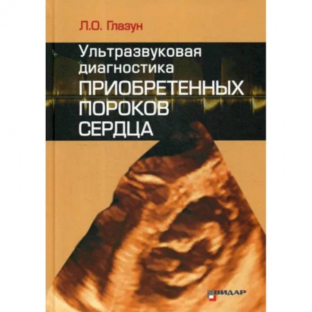 УЗИ. ЭКГ. Томография. Рентген, книга Ультразвуковая диагностика приобретенных пороков сердца купить по скидке
