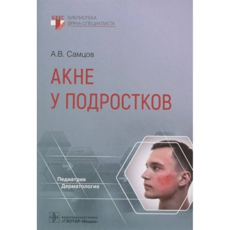 Книги, книга Акне у подростков купить по скидке