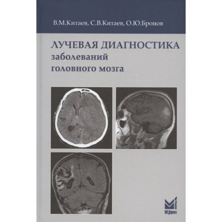 УЗИ. ЭКГ. Томография. Рентген, книга Лучевая диагностика заболеваний головного мозга купить по скидке